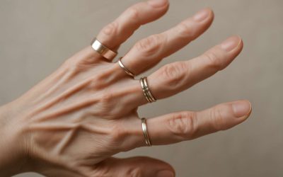 Discover How Silver Rings Hypermobility Can Enhance Flexibility and Style Effortlessly